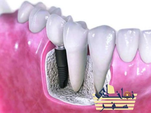 نمایشگاه تجهیزات دندانپزشکی گوانگجو 2024